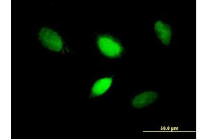 Immunofluorescence of purified MaxPab antibody to T on HeLa cell. (T Brachyury Protein (AA 1-377) Antikörper)