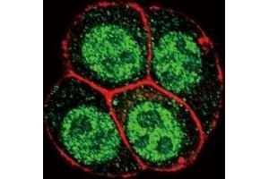 Confocal immunofluorescent analysis of phospho-SMAD2 antibody with HeLa cells followed by Alexa Fluor 488-conjugated goat anti-rabbit lgG (green).
