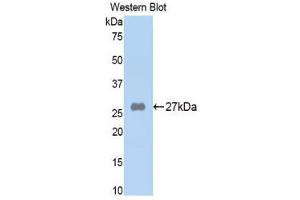 Western Blotting (WB) image for anti-alpha-2-Macroglobulin (A2M) (AA 818-1048) antibody (ABIN1857845)