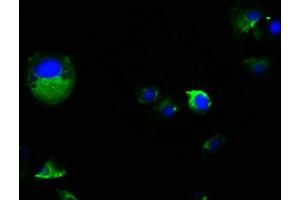 Immunofluorescence staining of MCF-7 cells with ABIN7163836 at 1:100, counter-stained with DAPI.