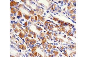 Immunohistochemistry (IHC) image for anti-Protein Kinase C and Casein Kinase Substrate in Neurons 2 (PACSIN2) (AA 342-371) antibody (ABIN5647224)