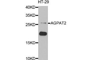 Western blot analysis of extracts of HT-29 cells, using AGPAT2 antibody. (AGPAT2 Antikörper)