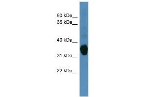 WB Suggested Anti-AKR1C1 Antibody Titration: 0. (AKR1C1 Antikörper  (N-Term))