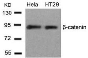 Image no. 3 for anti-Catenin (Cadherin-Associated Protein), beta 1, 88kDa (CTNNB1) (Ser33) antibody (ABIN197445) (CTNNB1 Antikörper  (Ser33))