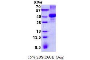 Amnionless (AMN) (AA 20-357) protein (His tag)