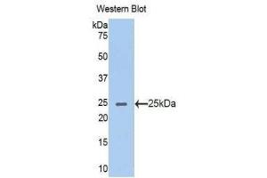 Western Blotting (WB) image for anti-Acetylcholinesterase (AChE) (AA 367-549) antibody (ABIN1857863) (Acetylcholinesterase Antikörper  (AA 367-549))