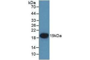 Detection of Recombinant F7, Mouse using Polyclonal Antibody to Coagulation Factor VII (F7) (Factor VII Antikörper  (AA 42-169))