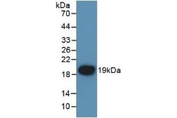 Factor VII antibody  (AA 42-169)