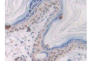 Immunohistochemistry (IHC) image for anti-Slit Homolog 1 (SLIT1) (AA 308-512) antibody (ABIN7438097)