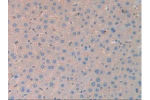 IHC-P analysis of Rat Liver Tissue, with DAB staining. (CA2 Antikörper)