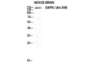 Western Blotting (WB) image for anti-Death-Associated Protein Kinase 1 (DAPK1) (Ser296) antibody (ABIN3174707) (DAP Kinase 1 Antikörper  (Ser296))