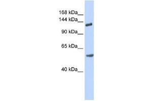 Western Blotting (WB) image for anti-Roundabout, Axon Guidance Receptor, Homolog 2 (ROBO2) antibody (ABIN2458930) (ROBO2 Antikörper)