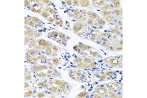 Immunohistochemistry of paraffin-embedded human gastric using SPATA4 antibody at dilution of 1:100 (x40 lens). (SPATA4 Antikörper)
