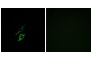 Immunofluorescence analysis of A549 cells, using FPR1 antibody.