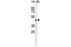 CHST2 Antibody (Center) western blot analysis in HL-60 cell line lysates (35µg/lane). (CHST2 Antikörper  (Middle Region))