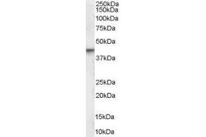 Western Blotting (WB) image for Vitamin D Receptor (VDR) peptide (ABIN369128) (Vitamin D Receptor (VDR) Peptid)