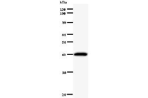 Western Blotting (WB) image for anti-Paired Box 3 (PAX3) antibody (ABIN931107) (Paired Box 3 Antikörper)