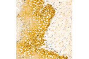 Immunohistochemistry analysis of paraffin embedded rat stomcah using CK6 (ABIN7074423) at dilution of 1: 1000 (Keratin 6 Antikörper)