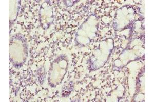 Immunohistochemistry of paraffin-embedded human small intestine tissue using ABIN7170406 at dilution of 1:100 (Sorting Nexin 7 Antikörper  (AA 85-330))