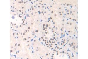 Used in DAB staining on fromalin fixed paraffin- embedded Kidney tissue (YAF2 Antikörper  (AA 1-177))