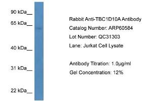 WB Suggested Anti-TBC1D10A  Antibody Titration: 0. (TBC1D10A Antikörper  (C-Term))