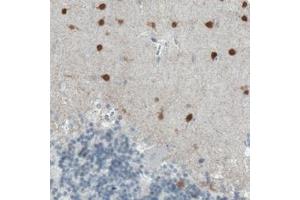 Immunohistochemical staining (Formalin-fixed paraffin-embedded sections) of human cerebellum with SCGN monoclonal antibody, clone CL0273  shows strong immunoreactivity in the molecular layer neurons. (SCGN Antikörper)