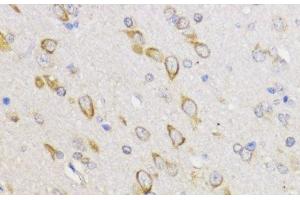 Immunohistochemistry of paraffin-embedded Rat brain using Bcl-2 Polyclonal Antibody at dilution of 1:100 (40x lens). (Bcl-2 Antikörper)
