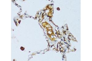 Immunohistochemistry of paraffin-embedded Human lung using C1QC Polyclonal Antibody at dilution of 1:100 (40x lens). (C1QC Antikörper)