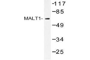 Western blot (WB) analysis of MALT1 antibody in extracts from HUVEC cells. (MALT1 Antikörper)