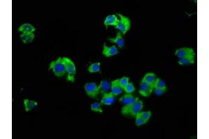 Immunofluorescence staining of MCF-7 cells with ABIN7175101 at 1:66, counter-stained with DAPI. (SLC14A1 Antikörper  (AA 1-51))