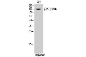 Western Blotting (WB) image for anti-PR (pSer294) antibody (ABIN3182419) (PR (pSer294) Antikörper)