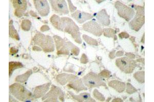 Immunohistochemical analysis of paraffin-embedded human heart tissue using COL5A1 polyclonal antibody . (COL5A1 Antikörper)