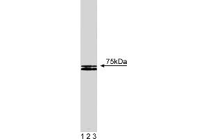 Western Blotting (WB) image for anti-Hematopoietic Cell-Specific Lyn Substrate 1 (HCLS1) (AA 17-190) antibody (ABIN968027)