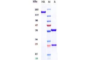 Anti-TIGIT Reference Antibody (tiragolumab) on SDS-PAGE under reducing (R) condition.