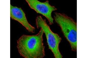 Fluorescent confocal image of HeLa cells stained with Tuberin antibody. (Tuberin Antikörper  (AA 1776-1805))