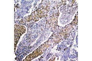 IHC analysis of LRTOMT using anti-LRTOMT antibody (ABIN7602986). (Leucine Rich Transmembrane and 0-Methyltransferase Domain Containing (LRTOMT) (Middle Region) Antikörper)