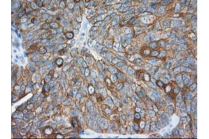 Immunohistochemistry (IHC) image for anti-Transforming, Acidic Coiled-Coil Containing Protein 3 (TACC3) antibody (ABIN1498098)
