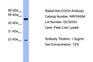 WB Suggested Anti-COCH  Antibody Titration: 0. (COCH Antikörper  (C-Term))