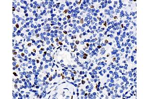 Immunohistochemistry analysis of paraffin-embedded human tonsil using ERK 2 Polyclonal Antibody at dilution of 1:100. (ERK2 Antikörper)