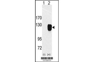 Western Blotting (WB) image for anti-Receptor Tyrosine Kinase-Like Orphan Receptor 1 (ROR1) (AA 32-62), (N-Term) antibody (ABIN5534646)