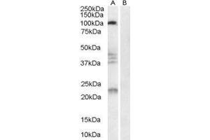 Western Blotting (WB) image for Reticulon 4 Receptor (RTN4R) peptide (ABIN369422) (Reticulon 4 Receptor (RTN4R) Peptid)