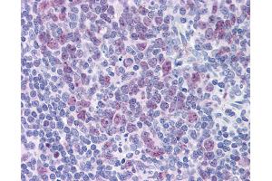 Anti-HDAC4 antibody IHC of human tonsil.