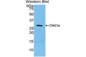 Western Blotting (WB) image for anti-Inhibitory Subunit of NF-KappaB zeta (AA 422-651) antibody (ABIN3205316) (Inhibitory Subunit of NF-KappaB zeta (AA 422-651) Antikörper)
