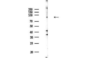anti-Mucosa Associated Lymphoid Tissue Lymphoma Translocation Gene 1 (MALT1) (Internal Region) antibody