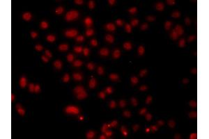 Immunofluorescence analysis of A549 cell using HNRNPA1 antibody. (HNRNPA1 Antikörper)