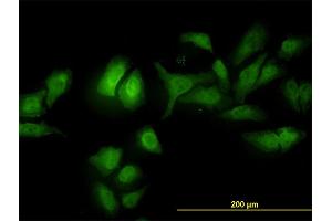 Immunofluorescence of monoclonal antibody to ADRM1 on HeLa cell. (ADRM1 Antikörper  (AA 18-407))