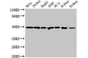 Western Blot Positive WB detected in: Hela whole cell lysate, Jurkat whole cell lysate, HepG2 whole cell lysate, A549 whole cell lysate, PC-3 whole cell lysate, Rat kidney tissue, Mouse kidney tissue All lanes: CALR antibody at 2 μg/mL Secondary Goat polyclonal to rabbit IgG at 1/50000 dilution Predicted band size: 49 kDa Observed band size: 49 kDa (Calreticulin Antikörper  (AA 18-415))