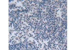 IHC-P analysis of lymph node tissue, with DAB staining. (NCR1 Antikörper  (AA 17-211))