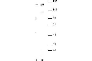 AIB1 antibody (pAb) tested by Western blot. (NCOA3 Antikörper)