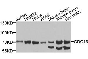 Western blot analysis of extracts of various cell lines, using CDC16 antibody. (CDC16 Antikörper)